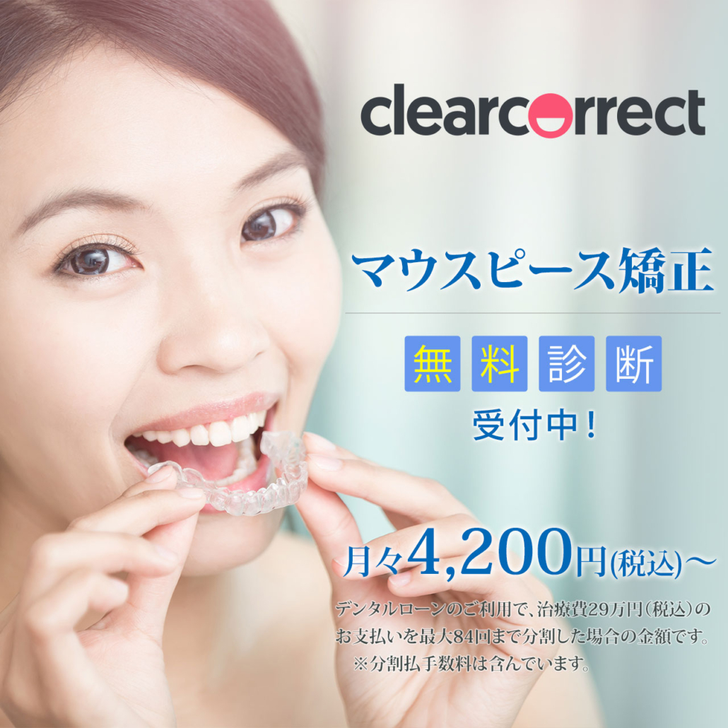 マウスピース矯正 クリアコレクト