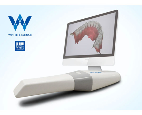 西大寺 吉野歯科矯正歯科クリニック 3Dスキャナー